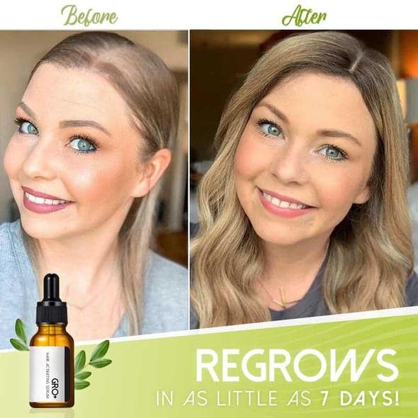 Vlasové aktivačné sérum Gro+ – Obrázok 3