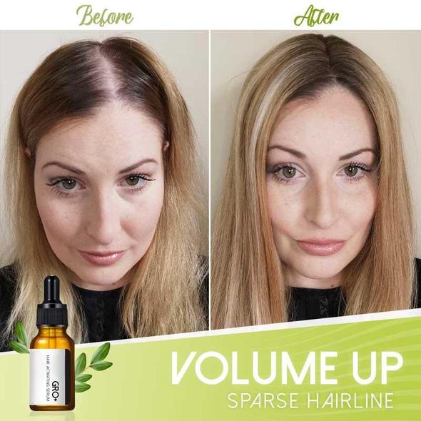 Vlasové aktivačné sérum Gro+ – Obrázok 4