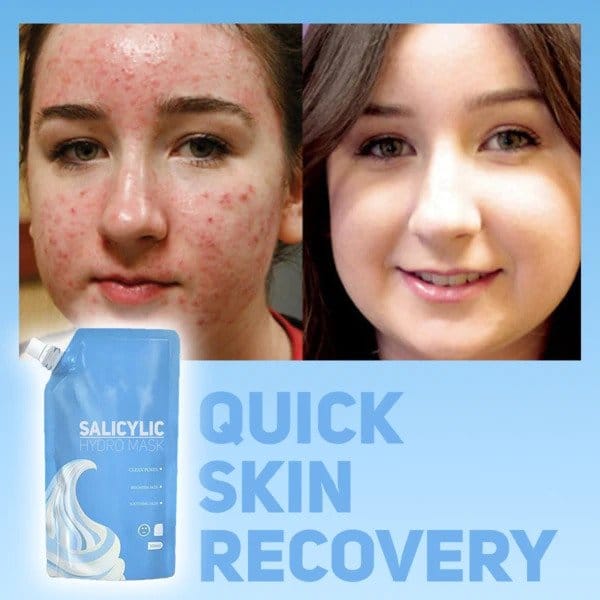 Salicylová hydromaska – Obrázok 4