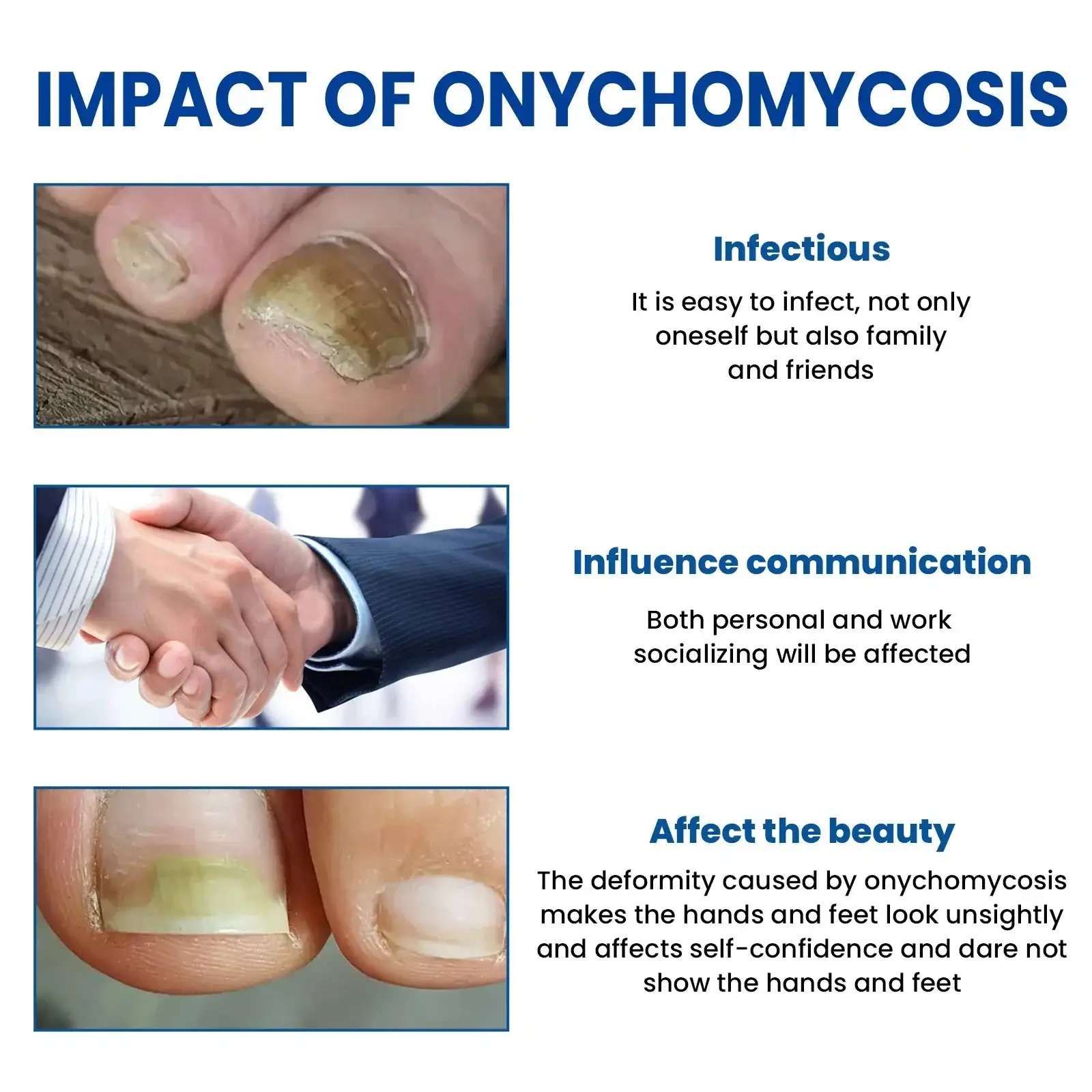 Plesňové náplasti na opravu nechtov – Obrázok 2