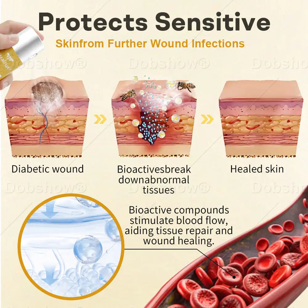Sprej na rany GlucoShield Bee Venom – Obrázok 3