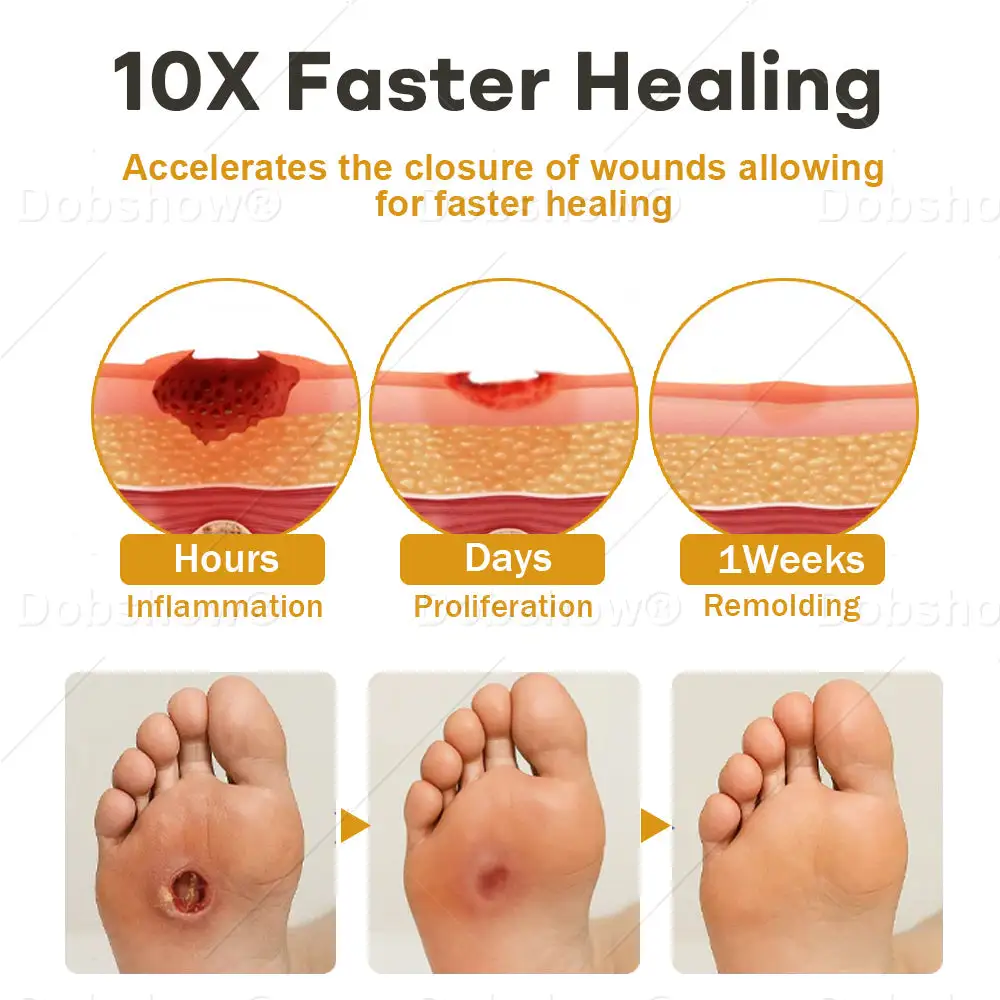 Sprej na rany GlucoShield Bee Venom – Obrázok 4