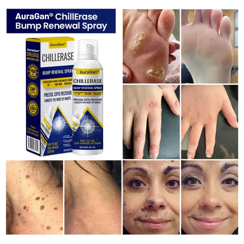 ChillErase Bump Renewal Spray – Obrázok 4