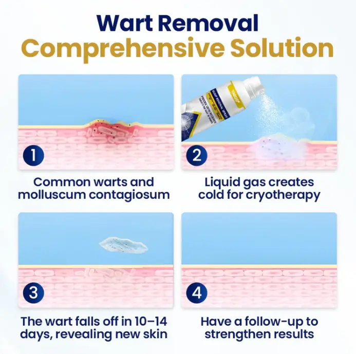 Chillique Bump Renewal Spray – Obrázok 3